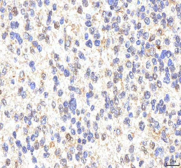 a03065 1 phf6 primary antibodies ihc testing 5