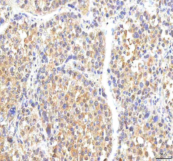 a03065 1 phf6 primary antibodies ihc testing 6