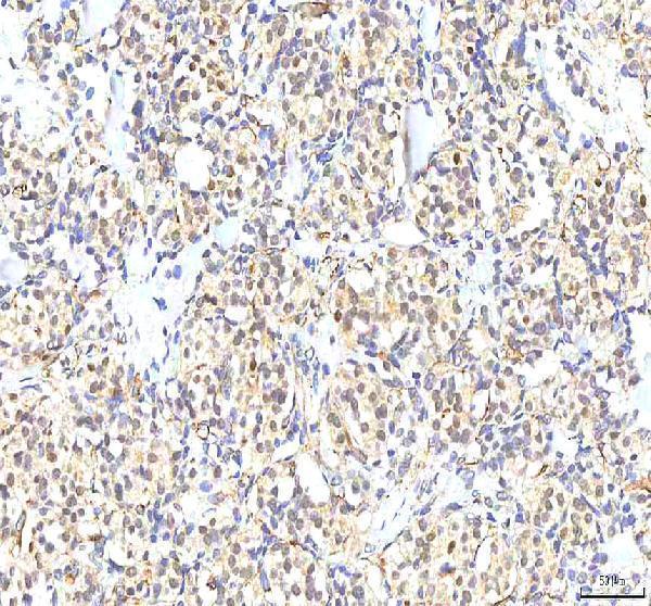 a03065 1 phf6 primary antibodies ihc testing 7