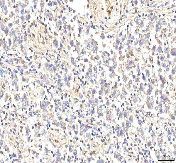 a03065 1 phf6 primary antibodies ihc testing 8