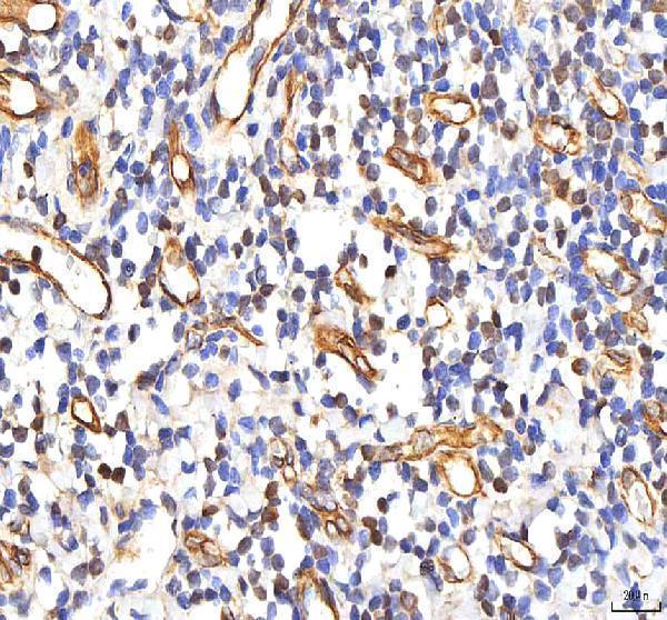 a03065 1 phf6 primary antibodies ihc testing 9