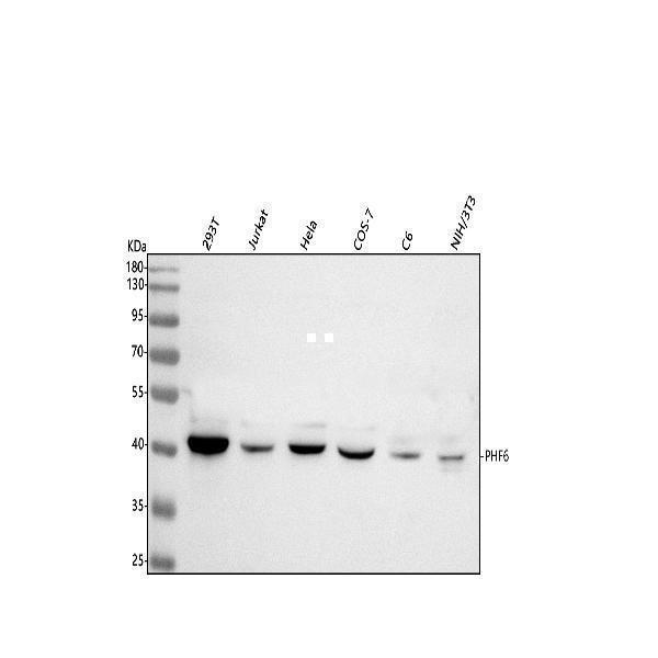  Western blot analysis of PHF6 using anti-PHF6 antibody (A03065-1)