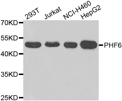 Western blot analysis of extracts of various cell lines, using PHF6 antibody