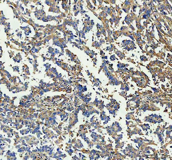  IHC analysis of GBP1 using anti-GBP1 antibody (A03067-1)