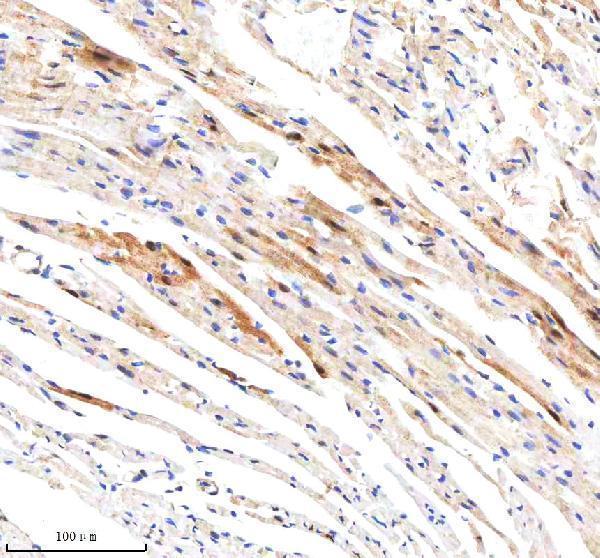  IHC analysis of GBP1 using anti-GBP1 antibody (A03067-1)