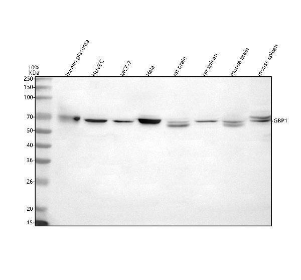  Western blot analysis of GBP1 using anti-GBP1 antibody (A03067-1)