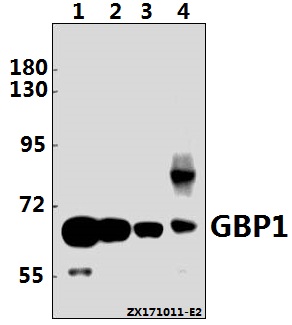 Western blot (WB) analysis of GBP1 (E99) pAb at 1:1000 dilution
Lane1:HEK293T whole cell lysate(10ug)
Lane2:HCT116 whole cell lysate(10ug)
Lane3:The Kidney tissue lysate of Rat(20ug)
Lane4:The Kidney tissue lysate of Mouse(40ug)