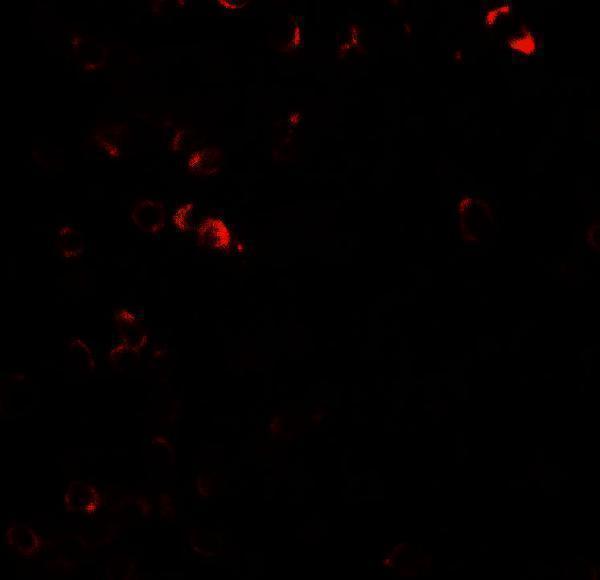 Immunofluorescence of E2F3 in human lymph node tissue with E2F3 antibody at 20 μg/ml