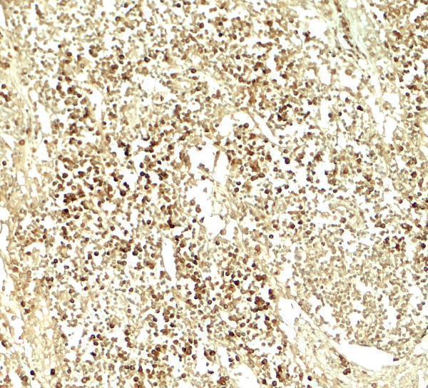 Immunohistochemistry of E2F3 in human lymph node tissue with E2F3 antibody at 5 μg/ml