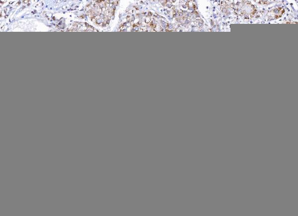  IHC analysis of E2F3 using anti-E2F3 antibody (A03068-4)