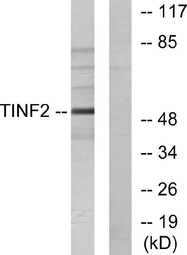 Western blot analysis of lysates from HUVEC cells, using TINF2 Antibody