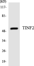Western blot analysis of the lysates from HeLa cells using TINF2 antibody