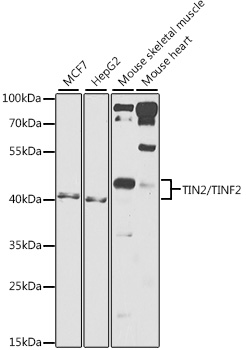 a03070 tinf2 primary antiboties wb testing 1