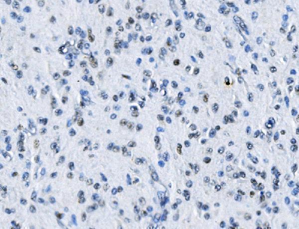a03073 1 mta2 primary antibodies ihc testing 2