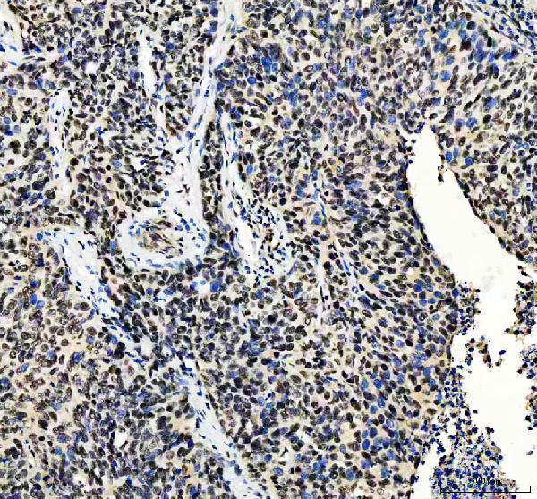 a03073 1 mta2 primary antibodies ihc testing 5