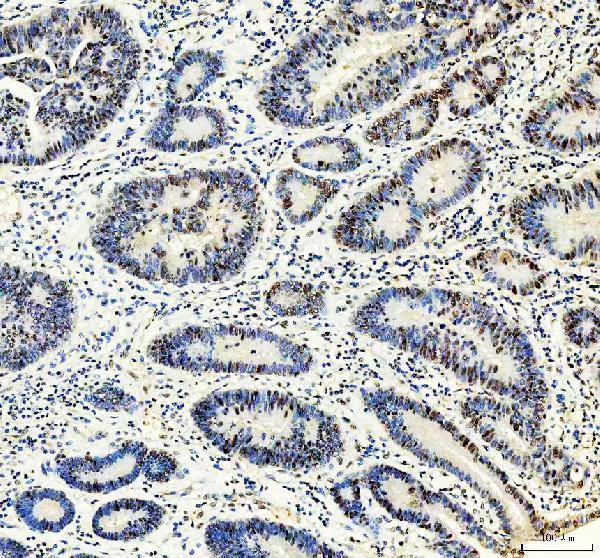 a03073 1 mta2 primary antibodies ihc testing 6