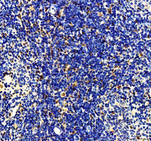 a03073 1 mta2 primary antibodies ihc testing 7