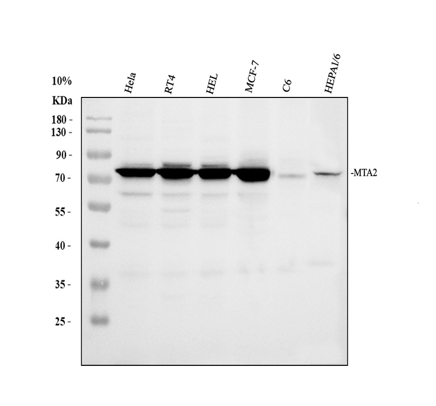 a03073 1 mta2 primary antibodies wb testing 1_1