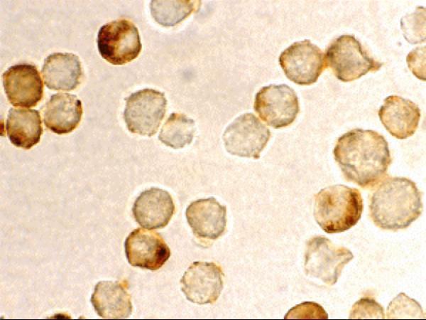 a03073 mta2 primary antibodies icc testing 2