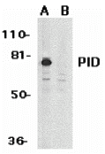 a03073 mta2 primary antibodies wb testing 1