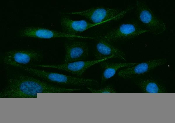  IF analysis of ADAM9 using anti-ADAM9 antibody (A03074-1)