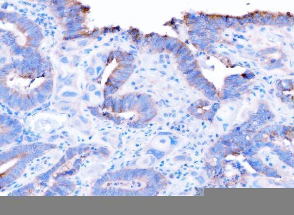  IHC analysis of ADAM9 using anti-ADAM9 antibody (A03074-1)