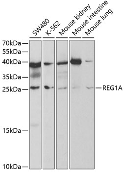 Western blot analysis of extracts of various cell lines, using REG1A antibody  at 1:1000 dilution
