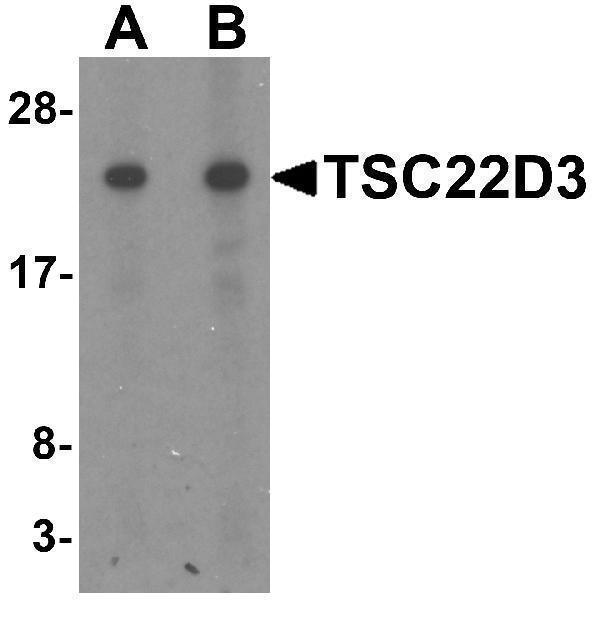 Western blot analysis of TSC22D3 in human small intestine tissue lysate with TSC22D3 antibody at (A) 1 and (B) 2 μg/mL