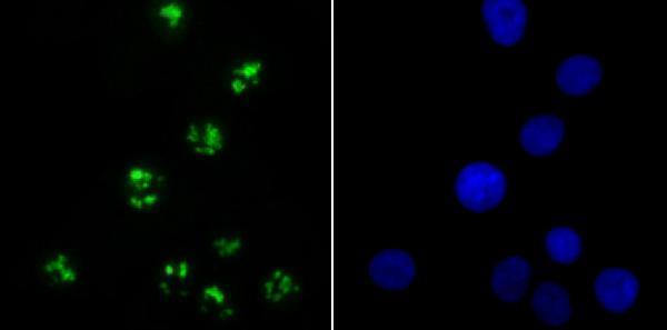 ICC staining KDM5A in A549 cells (green)