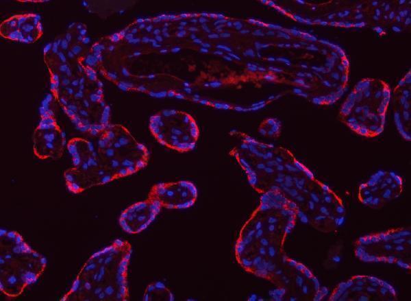 a03082 1 tpm2 primary antibodies if testing 9