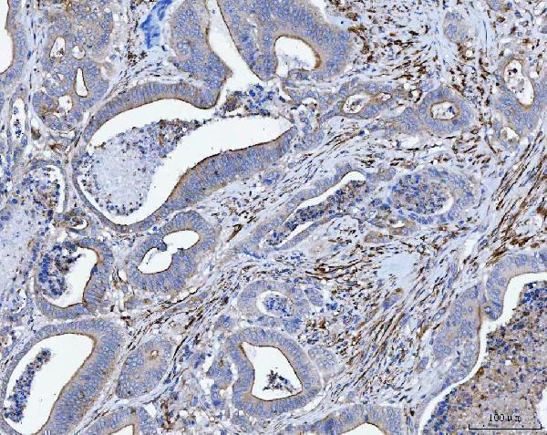  IHC analysis of Tropomyosin 2/TPM2 using anti-Tropomyosin 2/TPM2 antibody (A03082-1)