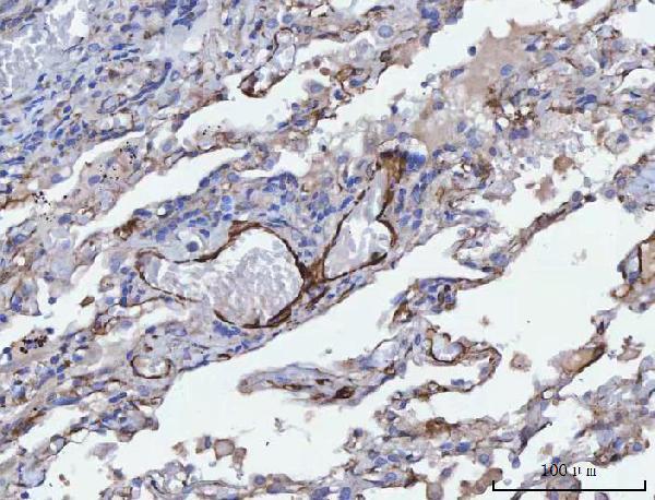  IHC analysis of Tropomyosin 2/TPM2 using anti-Tropomyosin 2/TPM2 antibody (A03082-1)