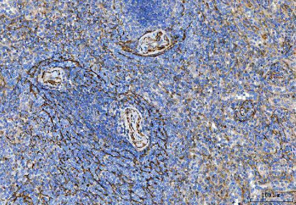a03082 1 tpm2 primary antibodies ihc testing 5