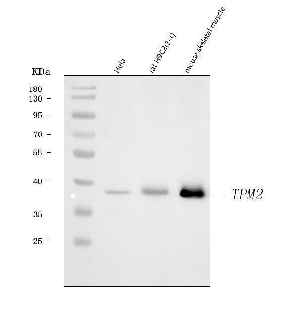  Western blot analysis of Tropomyosin 2/TPM2 using anti-Tropomyosin 2/TPM2 antibody (A03082-1)