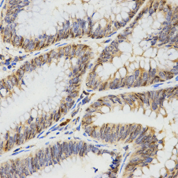 Immunohistochemistry of paraffin-embedded rat heart using TPM2 antibody  at dilution of 1:100 