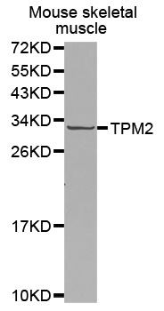 Western blot analysis of extracts of various cell lines, using TPM2 antibody  at 1:400 dilution