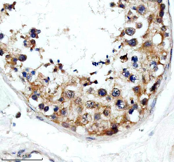 IHC analysis of SGO1 using anti-SGO1 antibody (A03083-3)