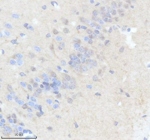 IHC analysis of SGO1 using anti-SGO1 antibody (A03083-3)