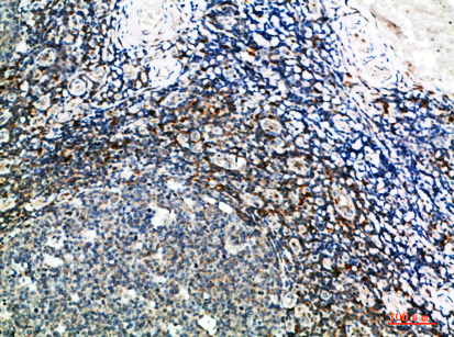 Immunohistochemical analysis of paraffin-embedded human-tonsil, antibody was diluted at 1:200