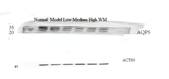 a03085 aquaporin 5 primary antibodies wb testing 2