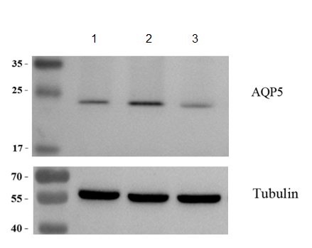 a03085 aquaporin 5 primary antibodies wb testing 3_1