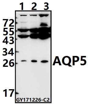 Western blot (WB) analysis of AQP5 (Y243) pAb at 1:500 dilution
Lane1:MCF-7 whole cell lysate(40ug)
Lane2:CT26 whole cell lysate(20ug)
Lane3:PC12 whole cell lysate(40ug)