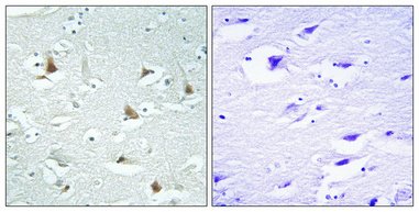 a03087 1 mlx primary antibodyes ihc testing 1