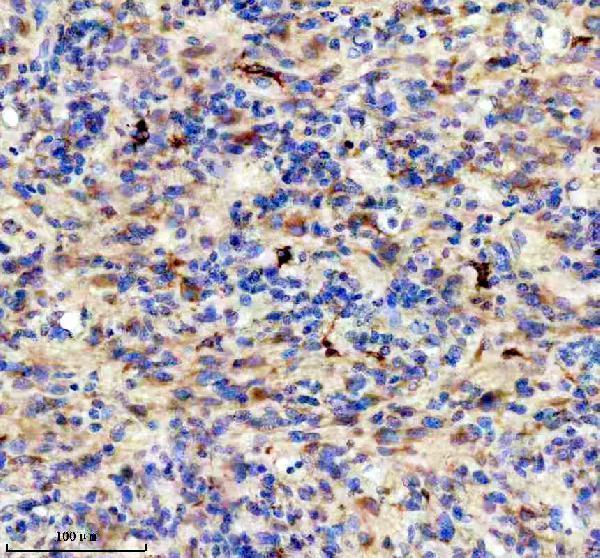 IHC analysis of DCLK1 using anti-DCLK1 antibody (A03089-1)