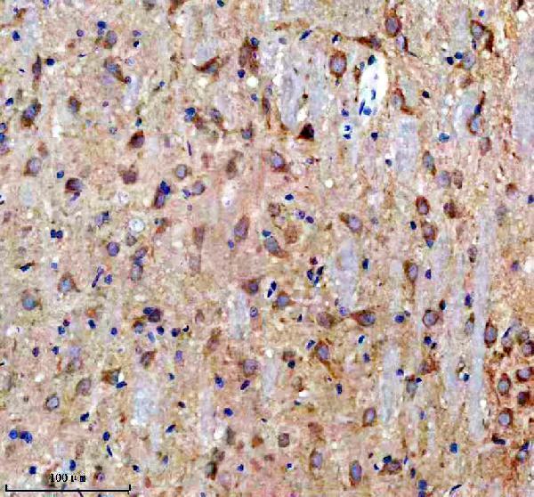 IHC analysis of DCLK1 using anti-DCLK1 antibody (A03089-1)