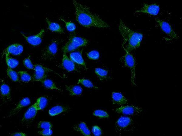  IF analysis of NOX5 using anti-NOX5 antibody (A03090)