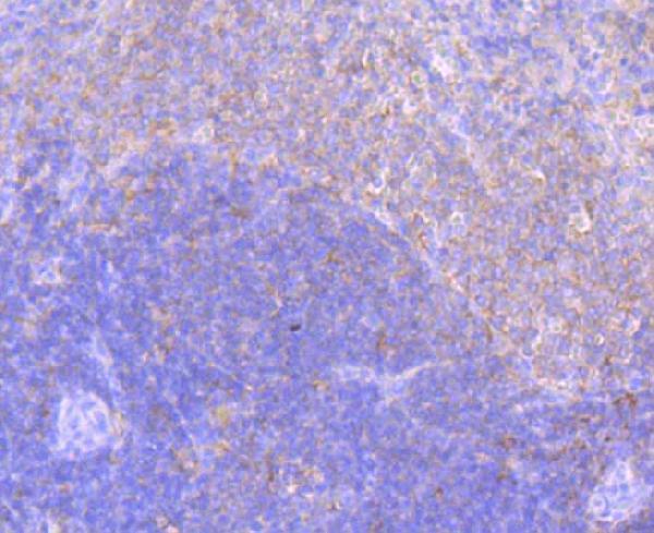 Immunohistochemical analysis of paraffin-embedded rat spleen tissue using anti-ELMO1 antibody