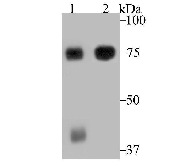 Western blot analysis of ELMO1 on mouse spleen tissue and Jurkat cell lysates using anti-ELMO1 antibody at 1/1,000 dilution