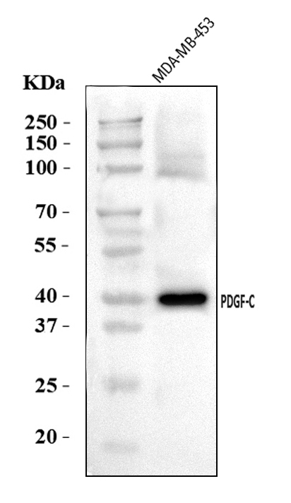  Western blot analysis of PDGFC using anti-PDGFC antibody (A03092-2)
