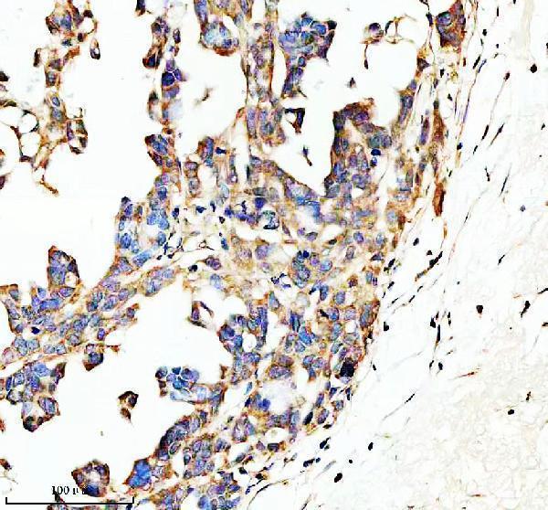IHC analysis of SPON1 using anti-SPON1 antibody (A03094-1)